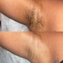 Brazilian Wax, Underarm Wax