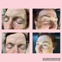 Dermaplaning Brightening