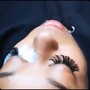 MicroNeedling