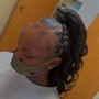 Scalp Treatment