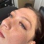 Dermaplaning Facial