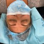 Eyelash Extension Removal