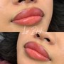 1ML Lip Filler