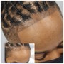 (In person) Scalp Micropigmentation Consultation