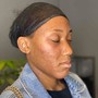 Mild Grade Chemical Peel