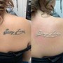 Laser Tattoo Removal On Small Area 5cmx10cm