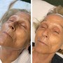 Age Reversing Exfoliation Treatment