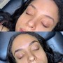 Dermaplane Facial