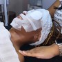 Chemical peel