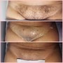 Brazilian Wax