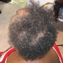 Scalp Treatment