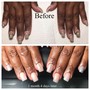 Nail Repair