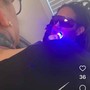 Teeth Whitening