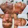 Back Facial