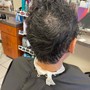 Alopecia/Hair Loss Consultation