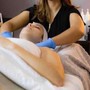 Skin Renewal Treatment