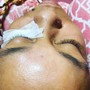 Eyelash Extension Removal