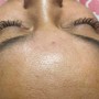 Eyelash Extension Removal