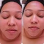 Back Facial - 90 Minutes