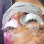 Eyelash Extension Removal