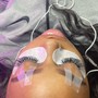 LASH REMOVAL