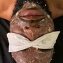 Dermaplaning