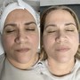 Couples Facial