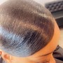 Scalp Treatment