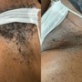 Brazilian Sugaring