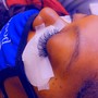 Eyelash Extension Removal