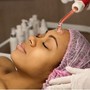 Chemical peel