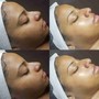 Back Facial