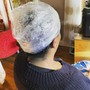 Scalp Treatment