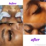 Eyelash Extension Removal