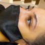 Dermaplaning