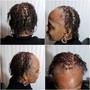 Alopecia Relaxer