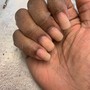 Callus Removal