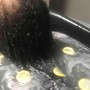 Scalp Treatment