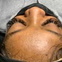 Facial treatment/ microdermabrasion