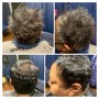 High Frequency Hair Follicle Treatment