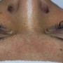 Eyelash Extension Removal