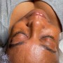 Oxygen Facial