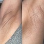 Men’s Brazilian Wax