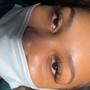 Eyelash Extension Removal