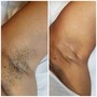 Underarm Wax