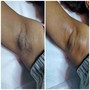 Underarm Wax