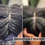 Dandruff Scalp Treatment