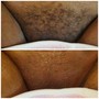 Brazilian Wax