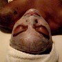 Facial