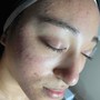 Dermaplaning (w/o facial)